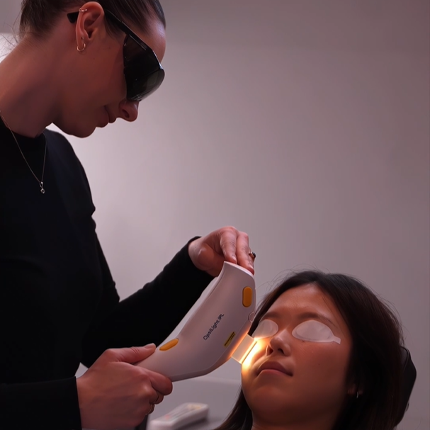 Dry Eye Treatment - Lumenis IPL